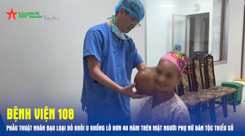 Bệnh viện 108 phẫu thuật nhân đạo loại bỏ khối u khổng lồ hơn 40 năm trên mặt người phụ nữ dân tộc thiểu số